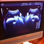 1000000762 1000000762.JPG