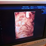 1000000764 1000000764.JPG