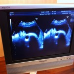 IMG_9183 IMG_9183.jpg